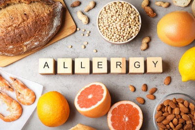 Test allergeni alimentari: guida completa, diagnosi e procedure