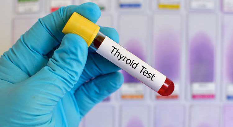 Analisi tiroide e profilo tiroideo