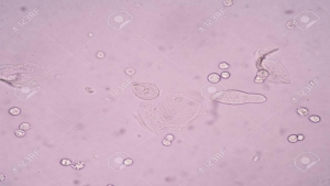 Cellule epiteliali: guida agli indicatori vitali nelle urine