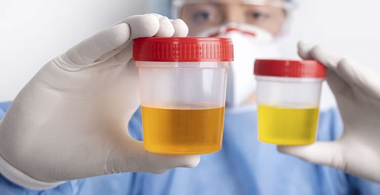 Esame urinocoltura: guida alla salute urinaria in inverno