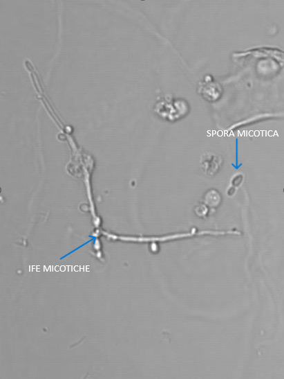 Candida Candida