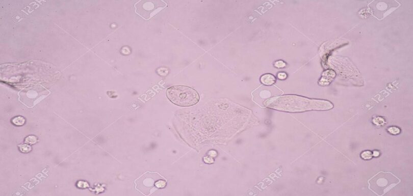Cellule epiteliali