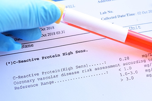 Proteina c reattiva alta