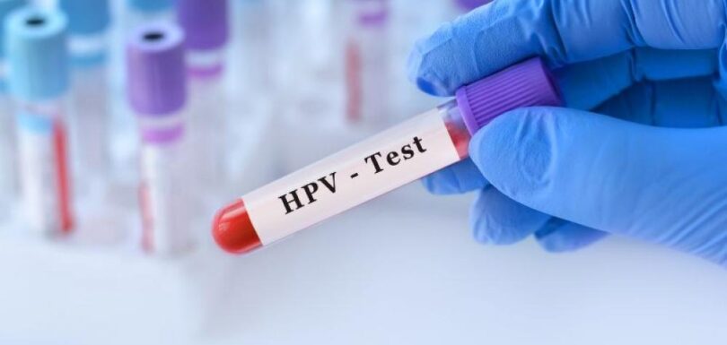 HPV Test
