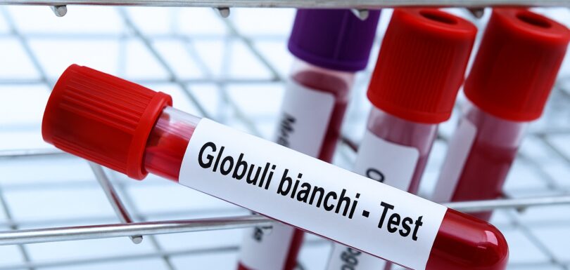 globuli bianchi